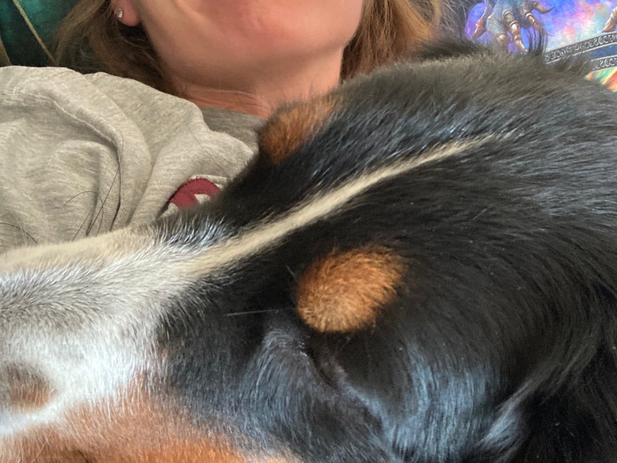 Chronic Fatigue does not equal&nbsp;Tired