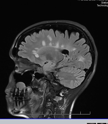 “You Don’t Look Sick”